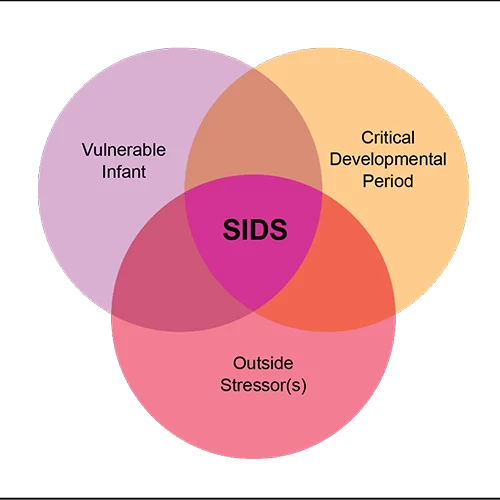 Pictured here in a venn diagram, the Triple-Risk Methods proposes that three elements must be present for sudden infant death syndrome to occur. Credit: National Institutes of Health Safe to Sleep campaign